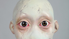 Islets of Aspergers Type  II 썸네일
