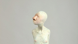 Islets of Aspergers Type  IX 썸네일