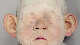 Islets of Aspergers Type XVI-ii 썸네일